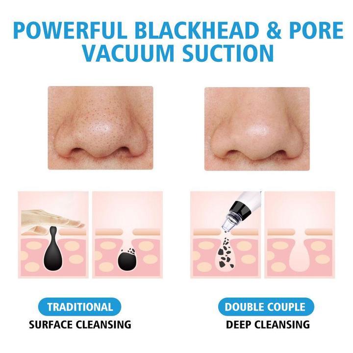 Blackhead Remover Pore Vacuum