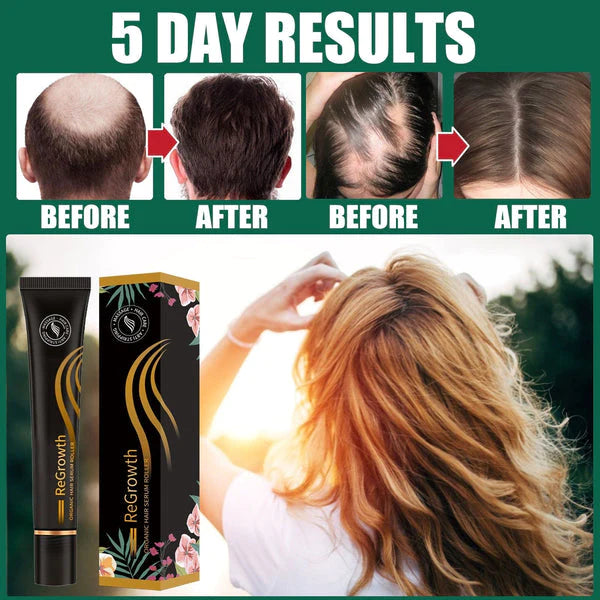Organic Hair Serum Roller (Buy 1 Get 1 Free)